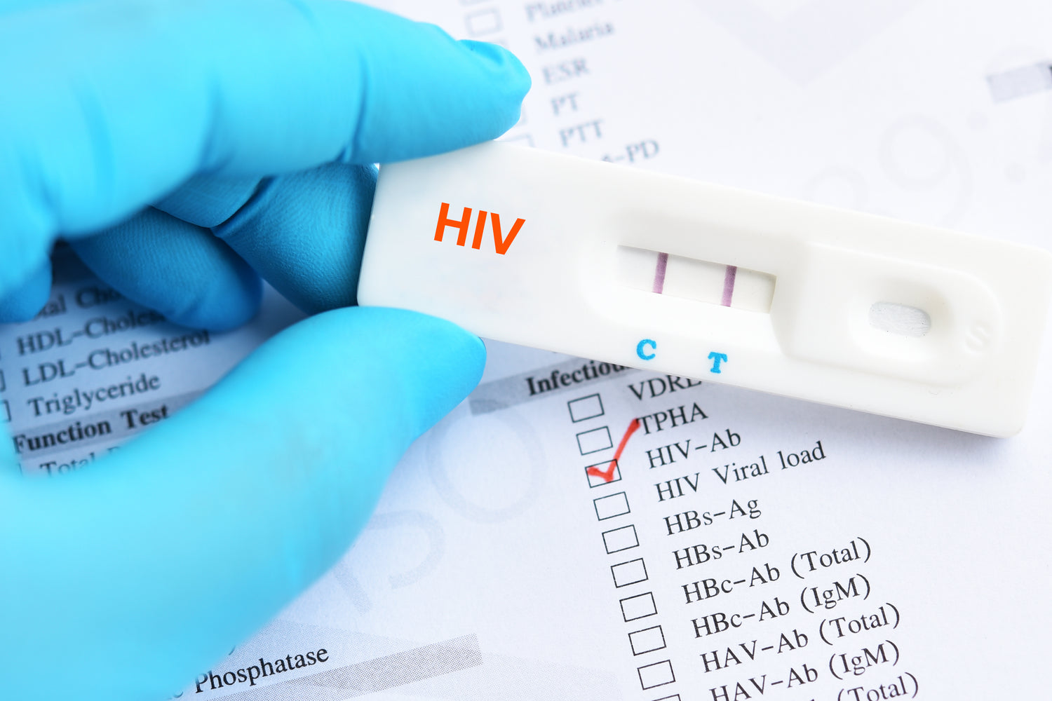 Cleartest® HIV 1.2 Schnelltest: Ein zuverlässiger Durchbruch in der HIV-Detektion