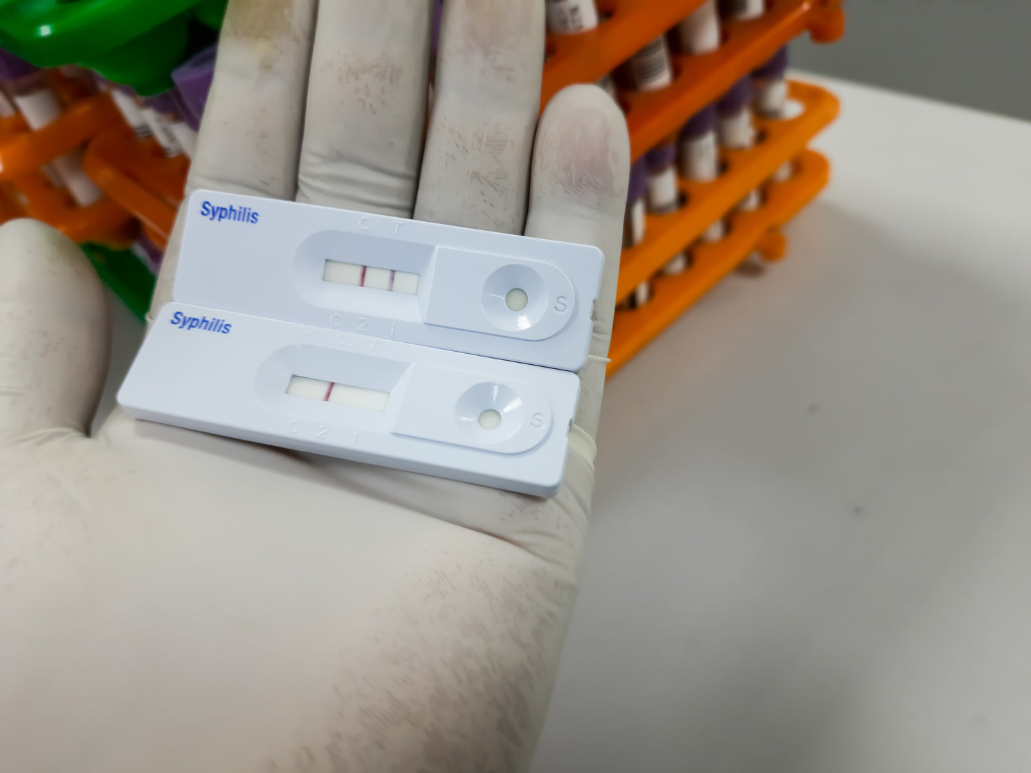 Cleartest® Syphilis-Schnelltest: Ein Durchbruch in der Schnelldiagnose