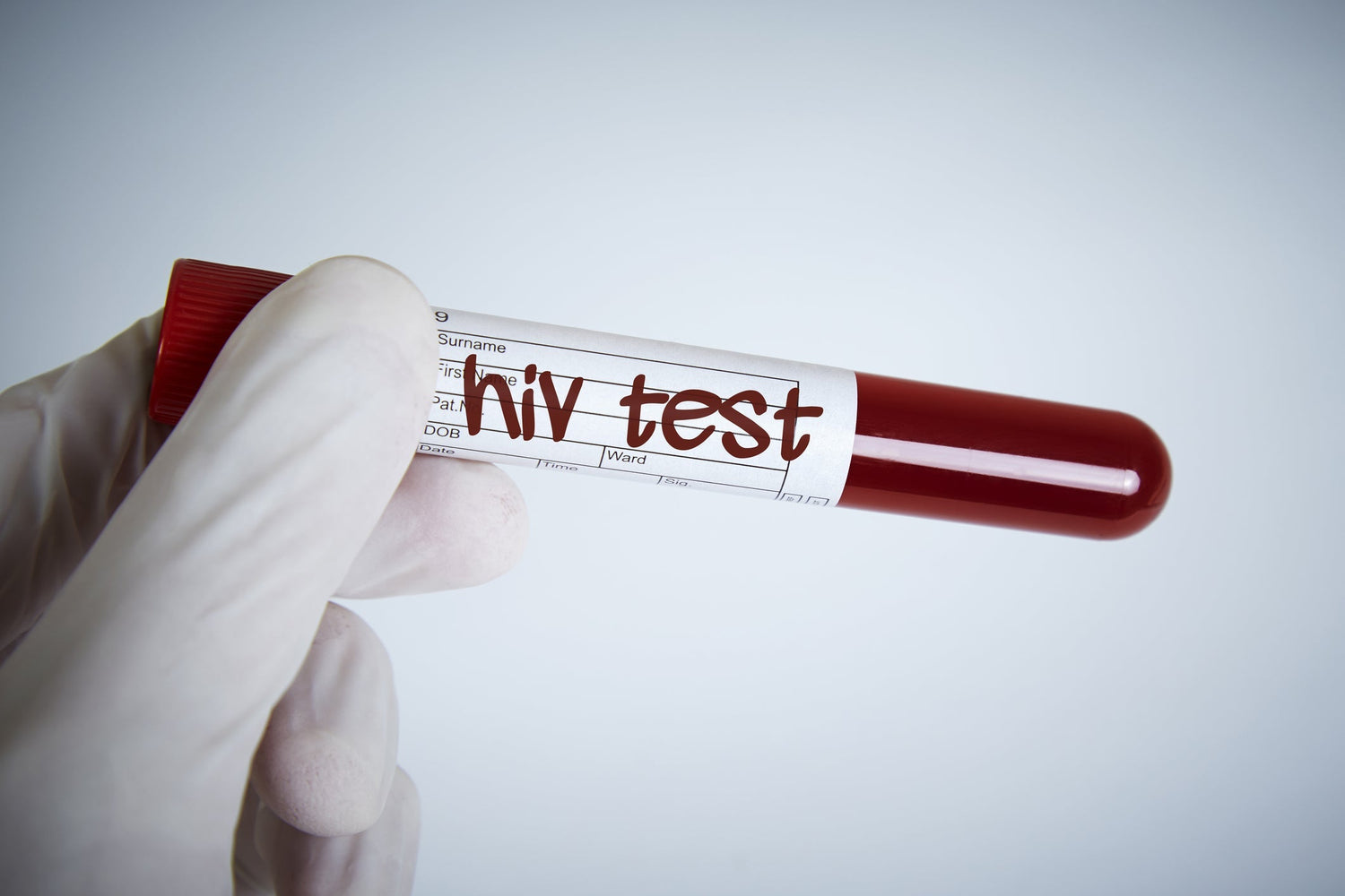 Testen auf HIV Tipps für die Durchführung zu Hause