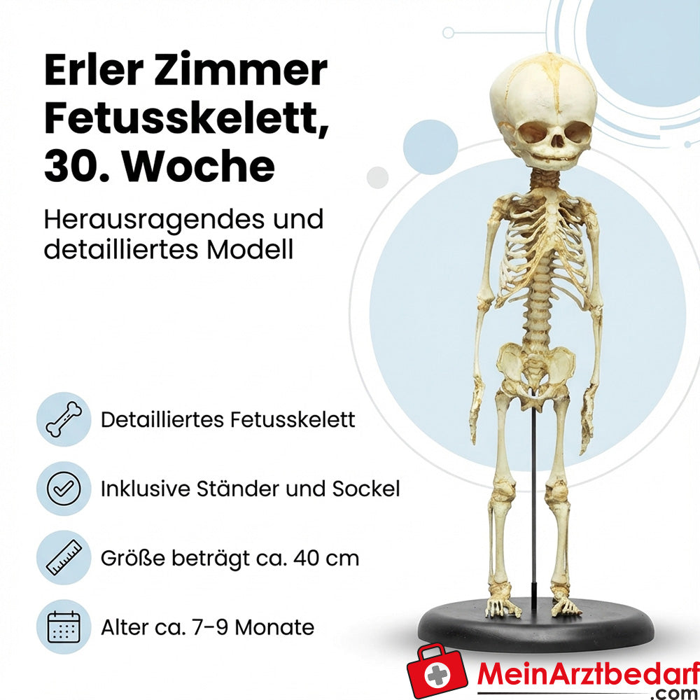 Erler Zimmer foetaal skelet, 32e week