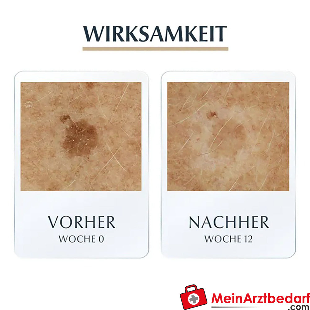 Eucerin® HYALURON-FILLER + ELASTICITY 3D Serum - Hautpflege gegen Altersflecken und Falten, 30ml.