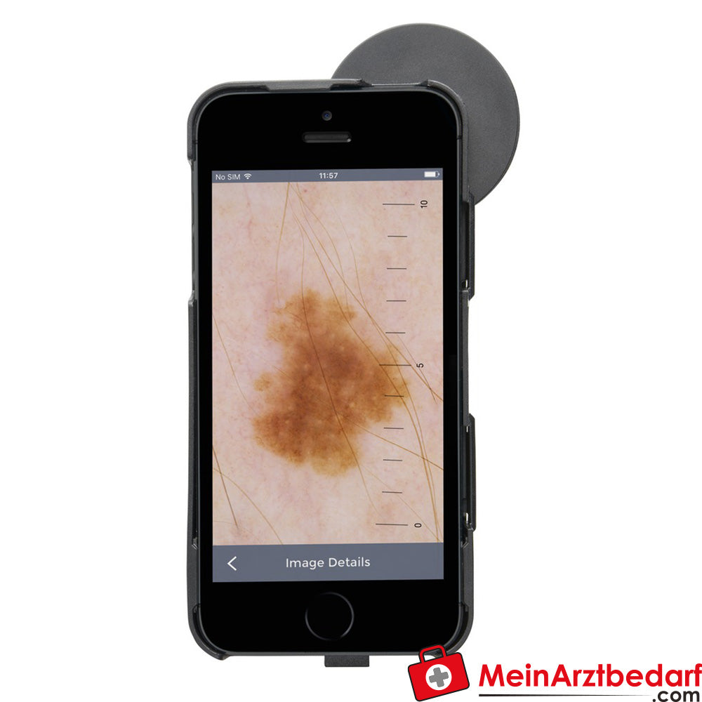 HEINE iC1 Dermatoskop.