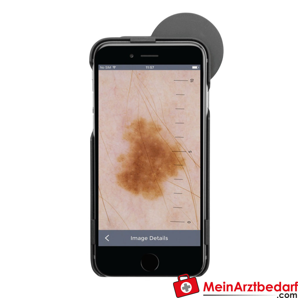 HEINE iC1 Dermatoskop.