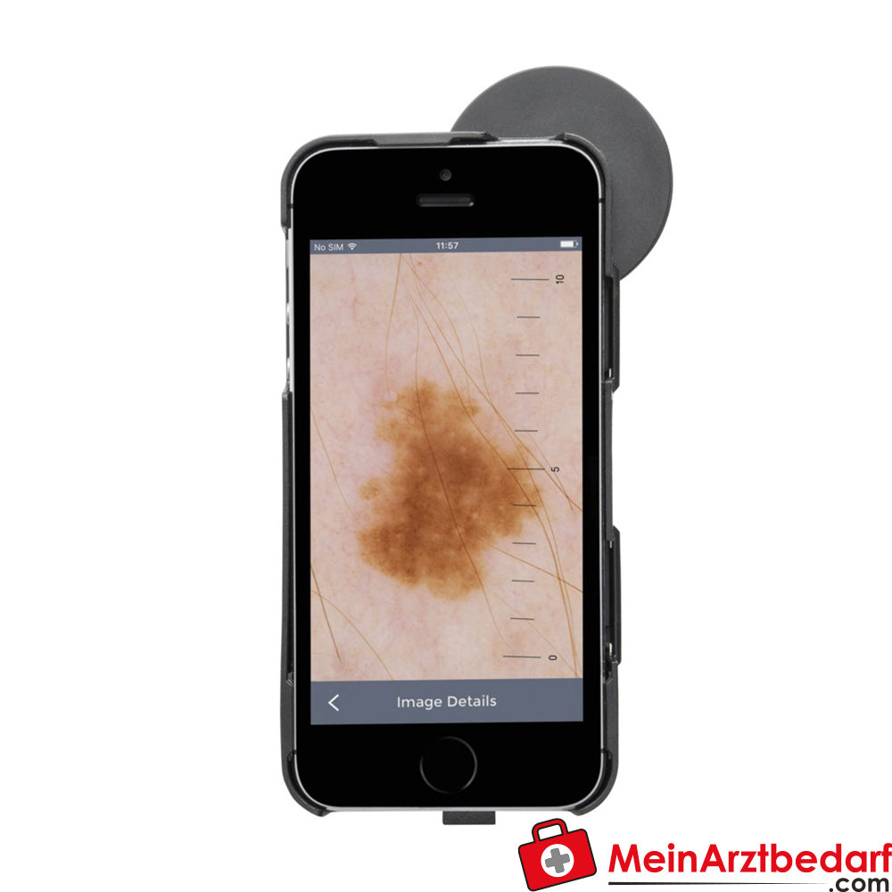 HEINE iC1 Dermatoskop.