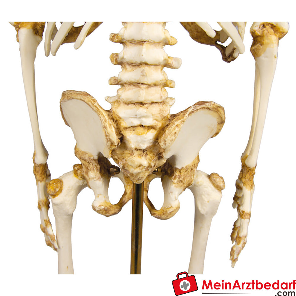 Erler Zimmer kinderskelet, 14 tot 16 maanden