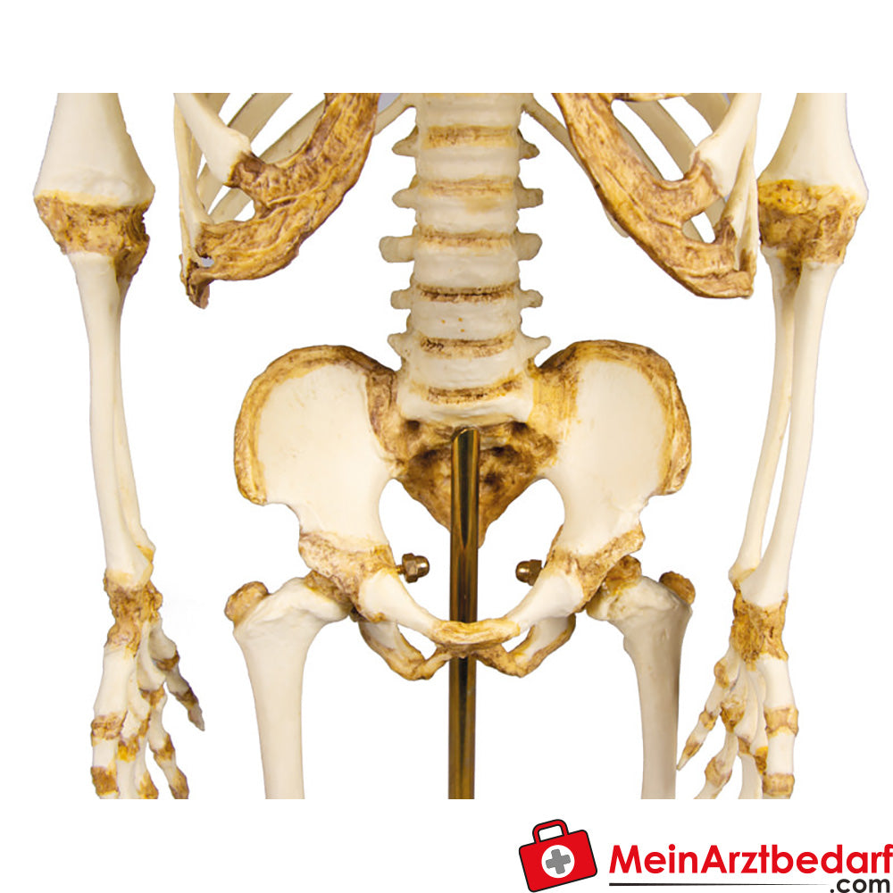 Erler Zimmer kinderskelet, 14 tot 16 maanden