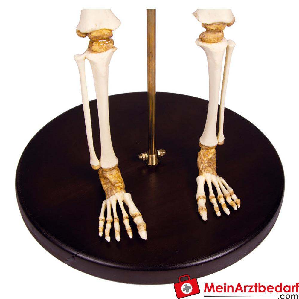 Erler Zimmer kinderskelet, 14 tot 16 maanden