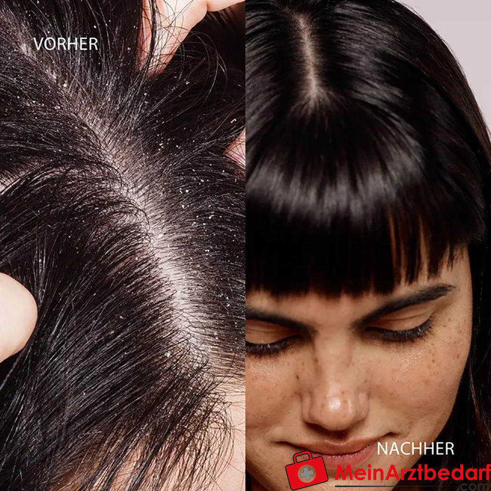 DUCRAY KELUAL DS Shampoo – Anti-Schuppen-Shampoo, 100ml.