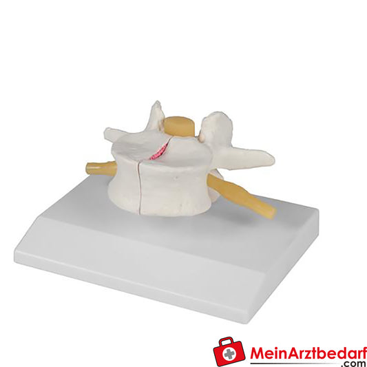 Erler-Zimmer Osteoporose.