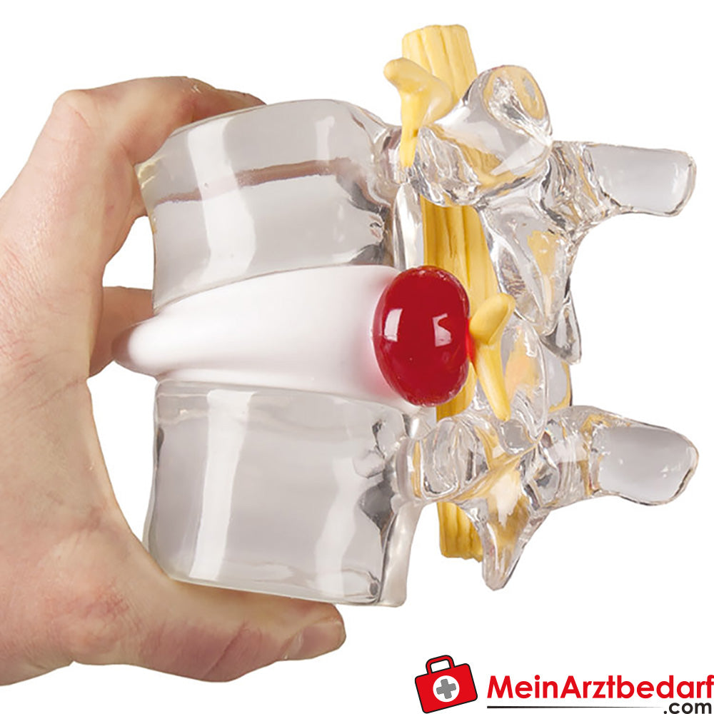 Erler-Zimmer Bandscheiben-Vorfall-Simulator.