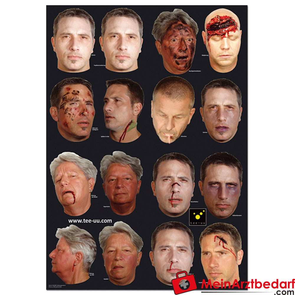 TEE-UU VERLETZUNGSMUSTER Set.