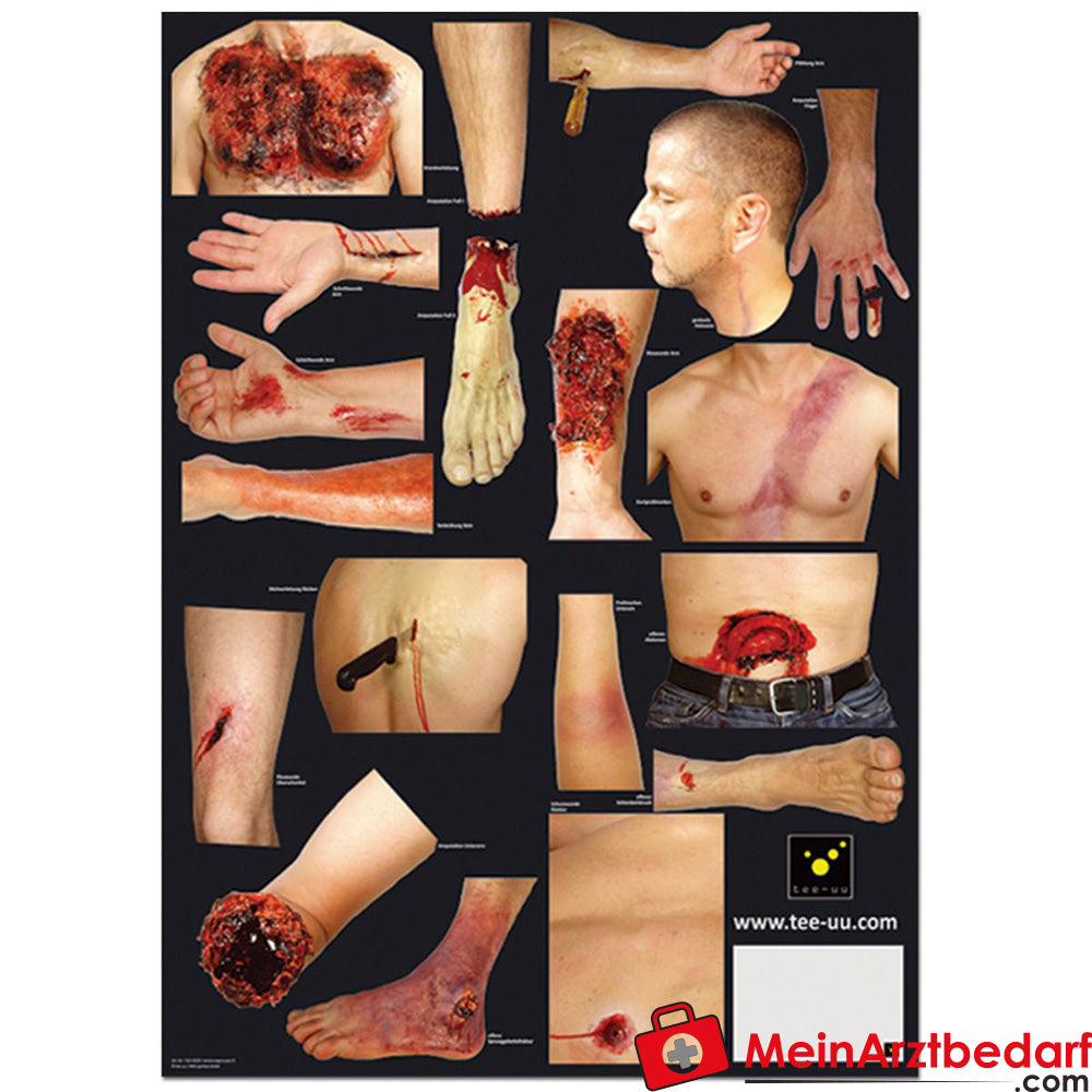 TEE-UU VERLETZUNGSMUSTER Set.