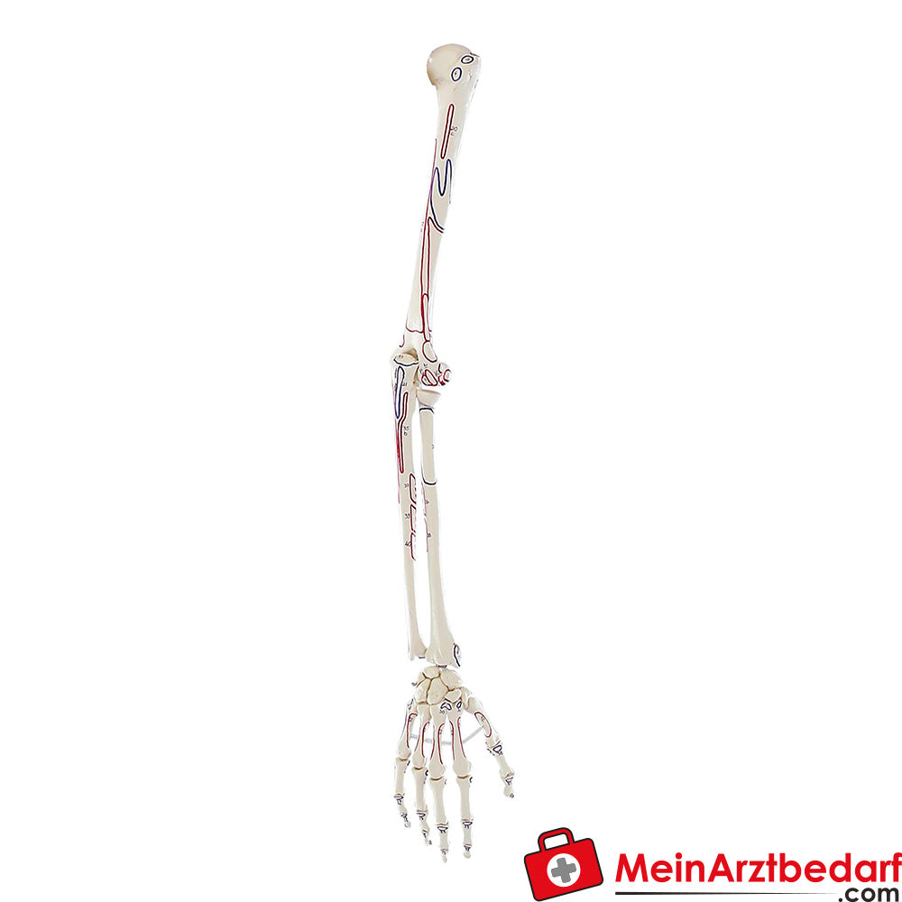 Erler-Zimmer Armskelett.