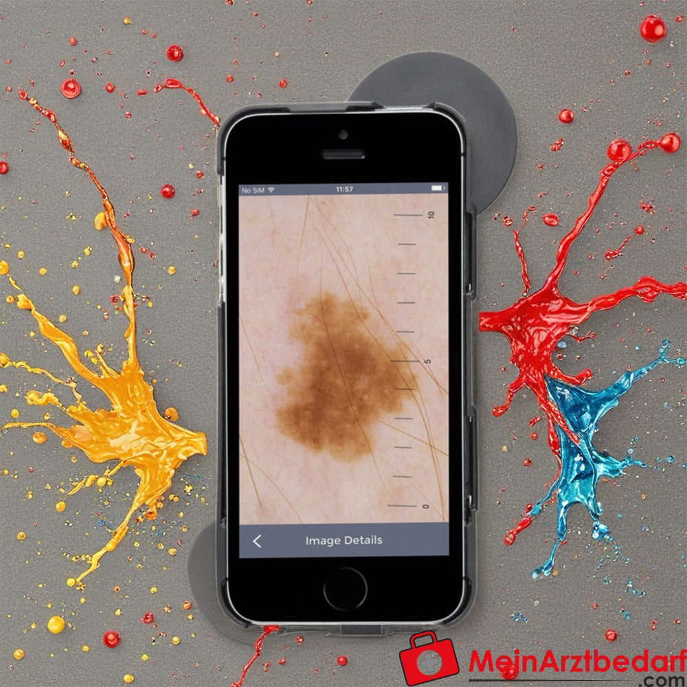 HEINE iC1 Dermatoskop.