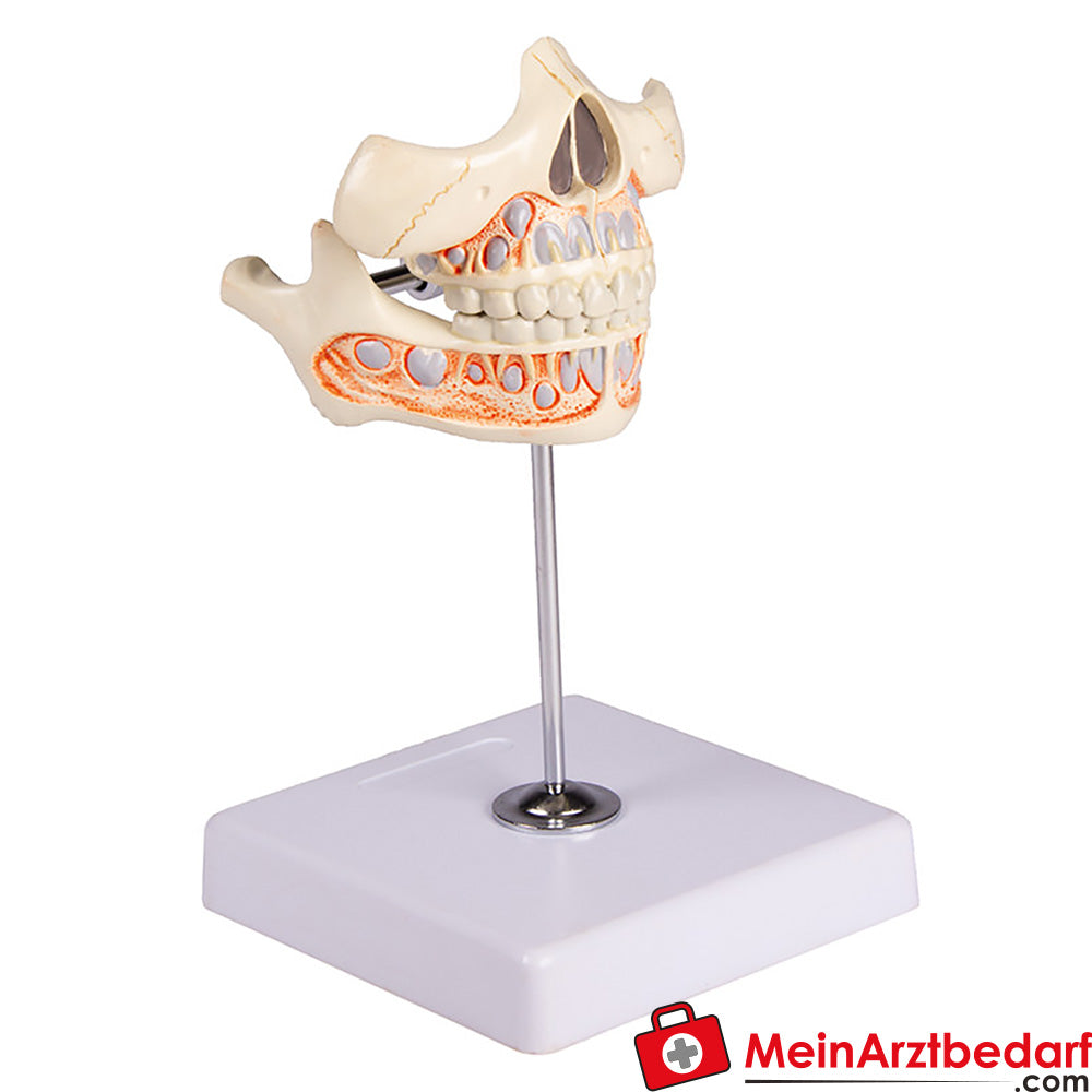 Erler-Zimmer Milchgebiß, 5jährig.