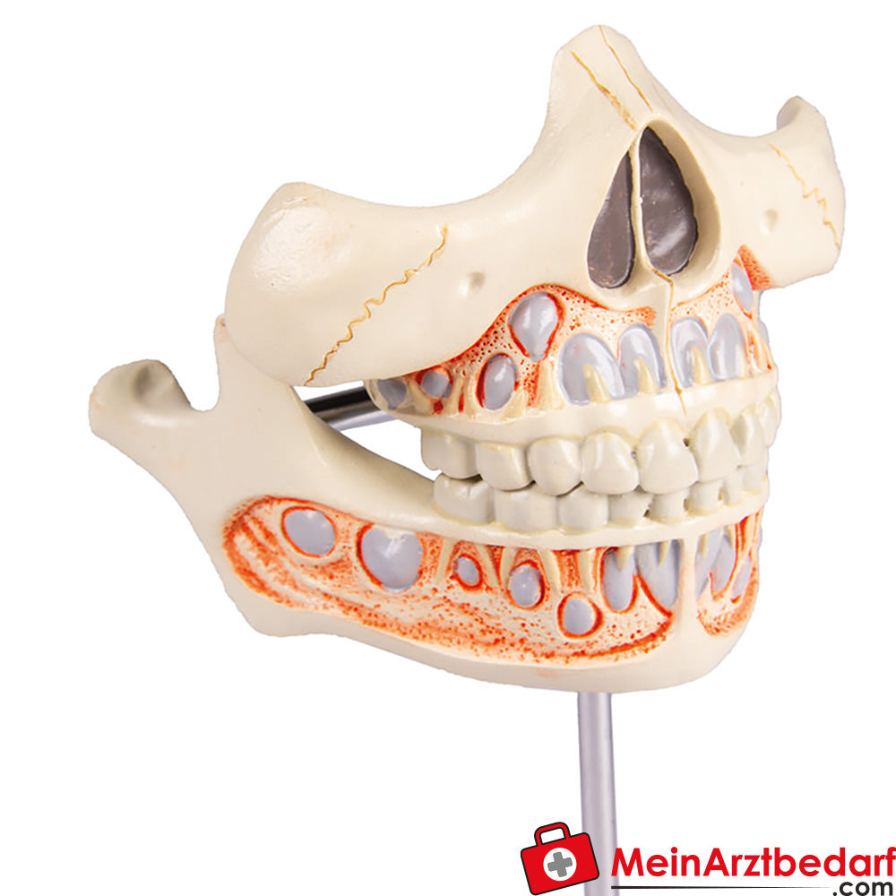 Erler-Zimmer Milchgebiß, 5jährig.