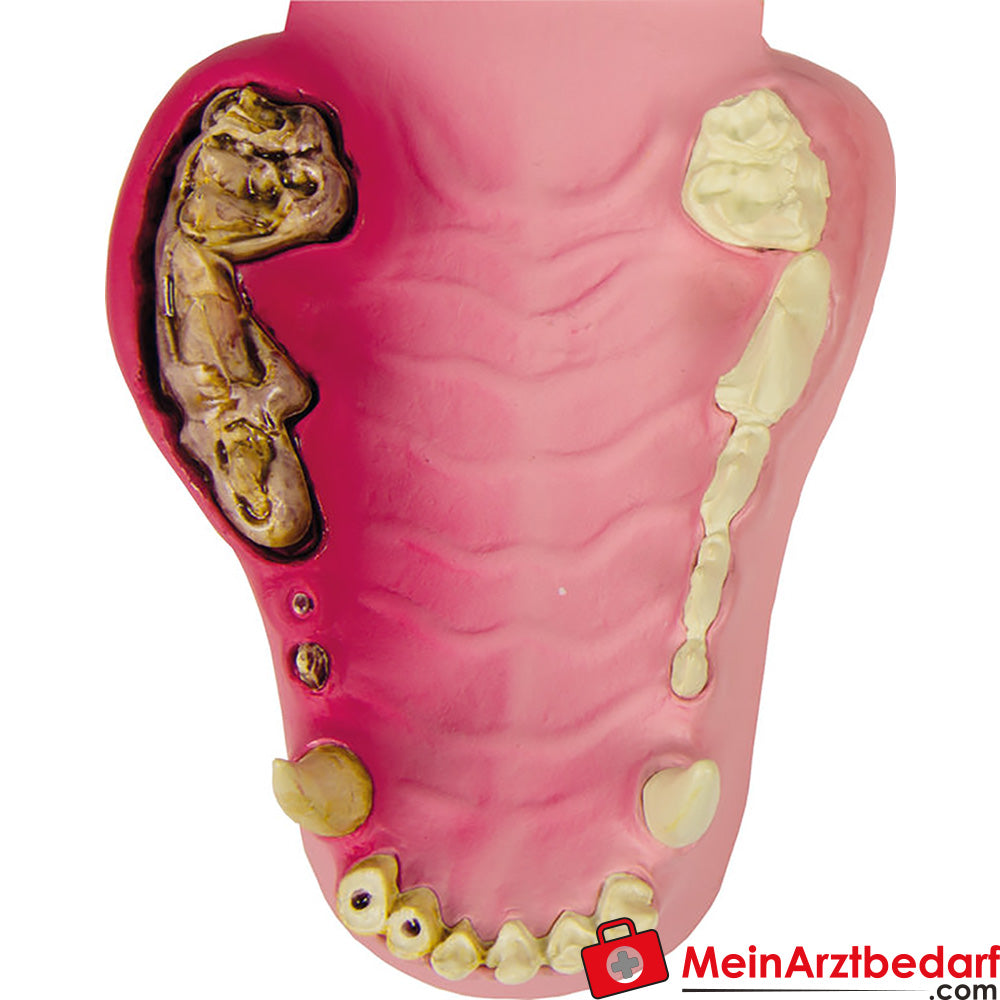 Erler-Zimmer Hundekiefer gesund/erkrankt.