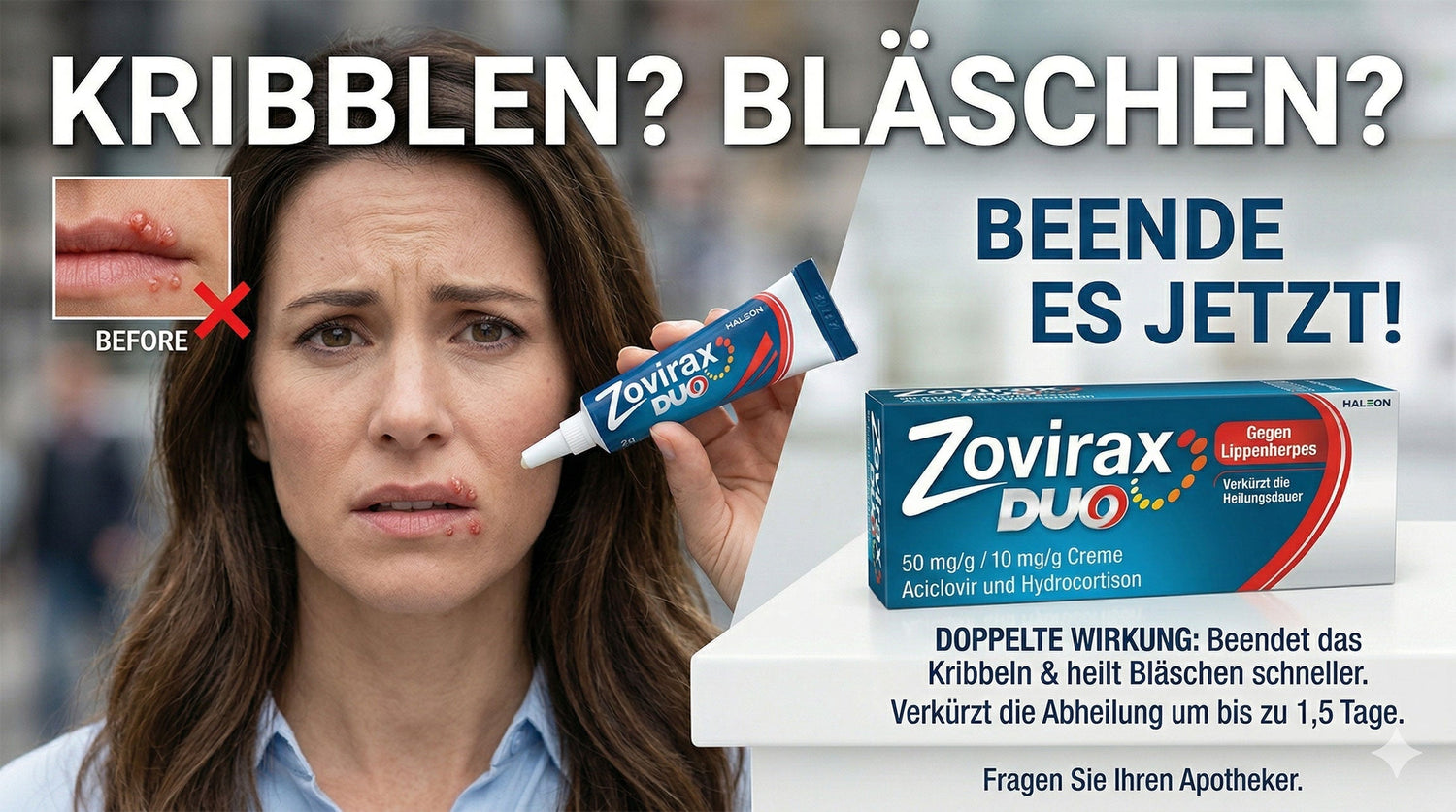 Lippen Herpes richtig behandeln. Was sagt die Wissenschaft