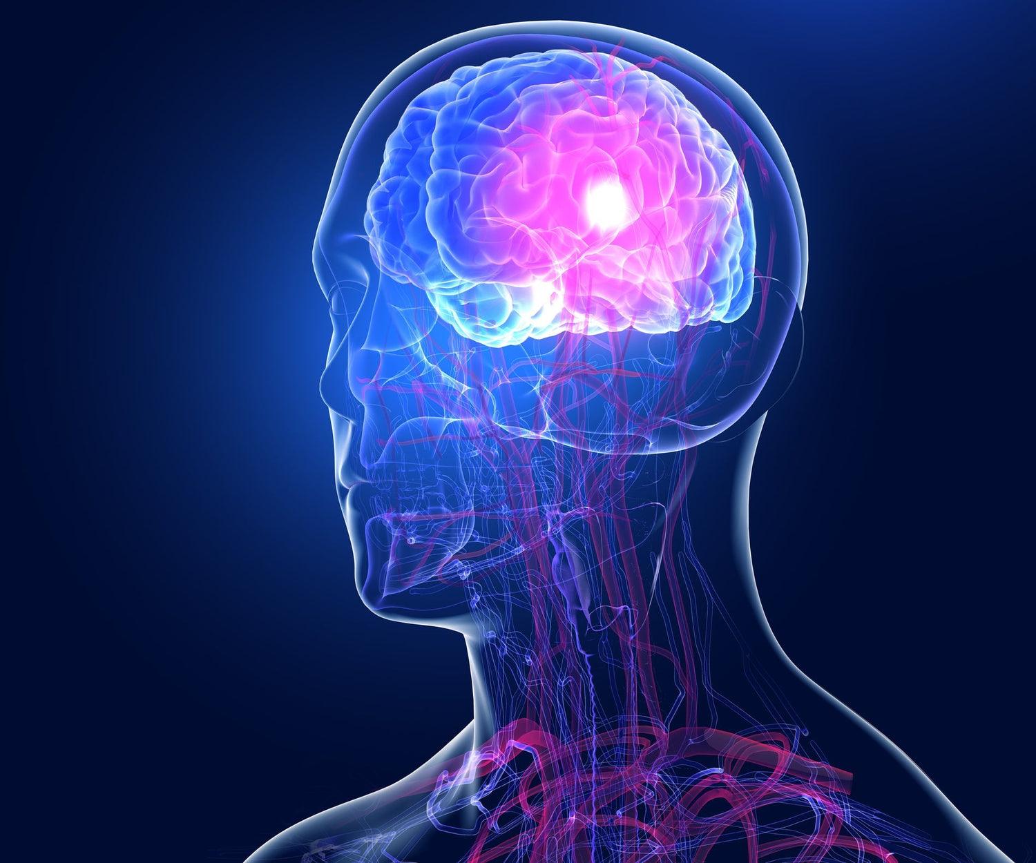 Hirnblutung. Frühwarnzeichen und Risikofaktoren