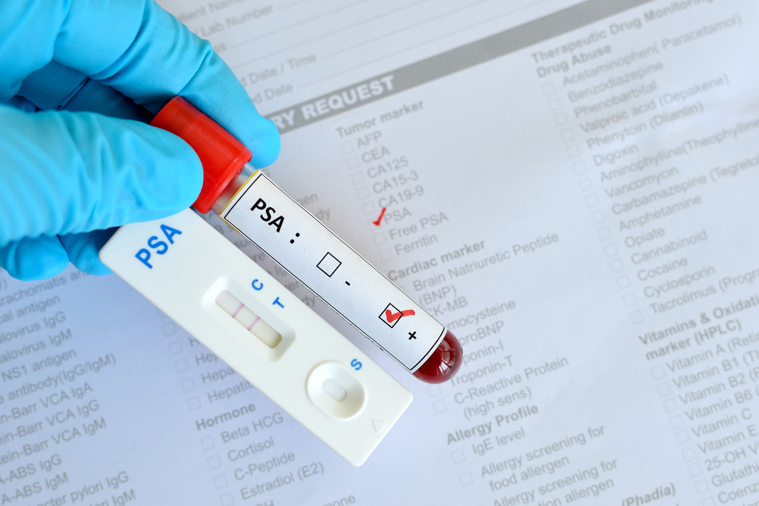 Der Cleartest® PSA-Schnelltest: Revolutionierung der PSA-Kontrolle