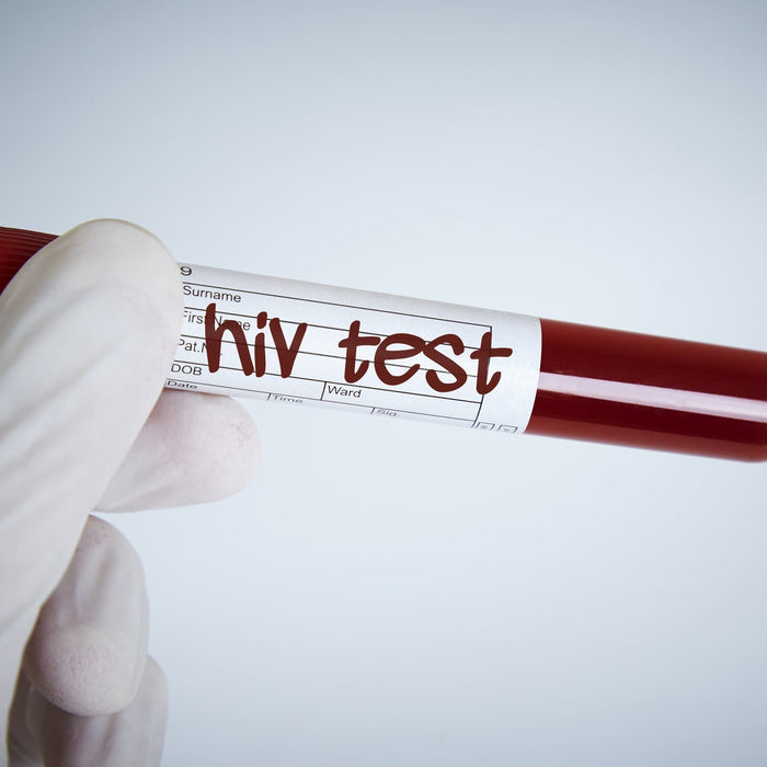 Testen auf HIV Tipps für die Durchführung zu Hause