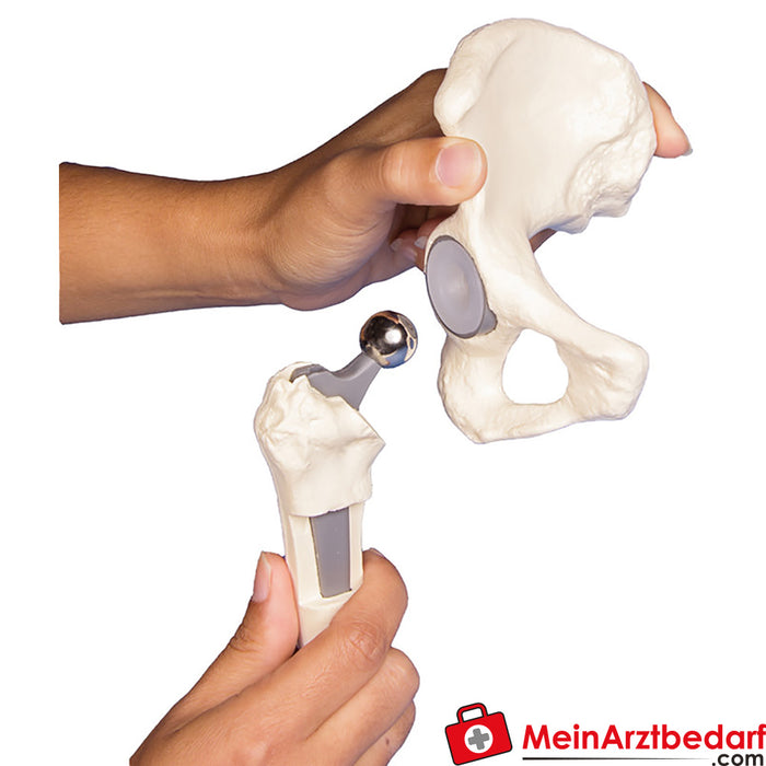 Erler Zimmer Hip implant model