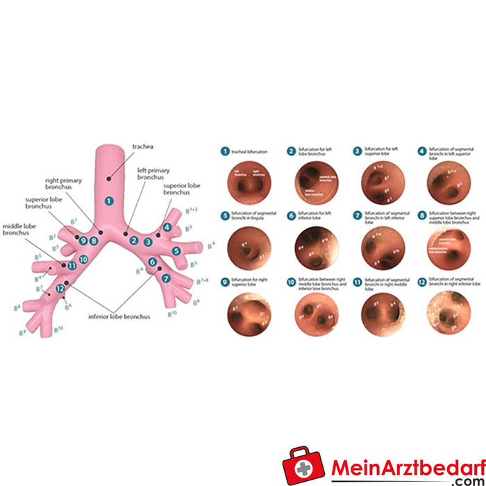 Erler Zimmer Bronchial tree for bronchofiberscopy for R16060