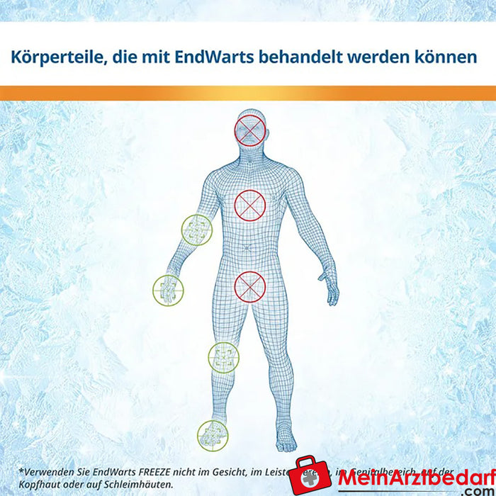 EndWarts FREEZE: Agente congelante para eliminar verrugas en manos, brazos y pies / 7.5g