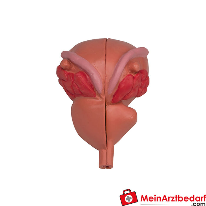 Erler Zimmer Prostate Model, 2-part