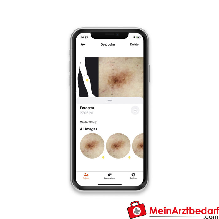 HEINE Derm App