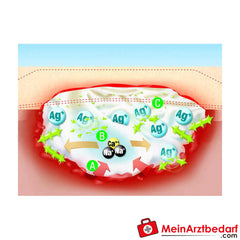 Suprasorb A+AG Antimikrobieller Calciumalginat-Verband.