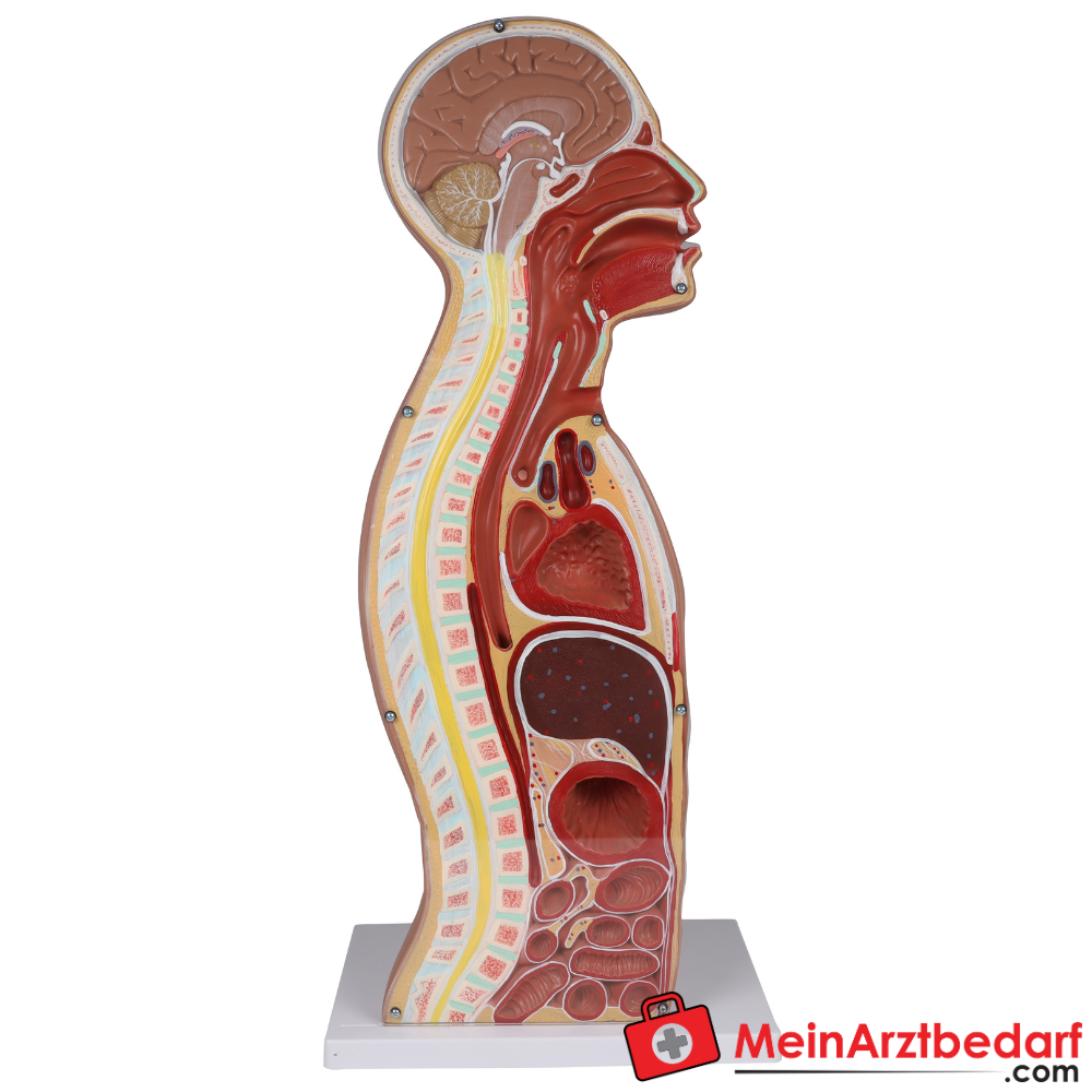 Erler-Zimmer NG Tracheostomie Torso, lebensgroß.
