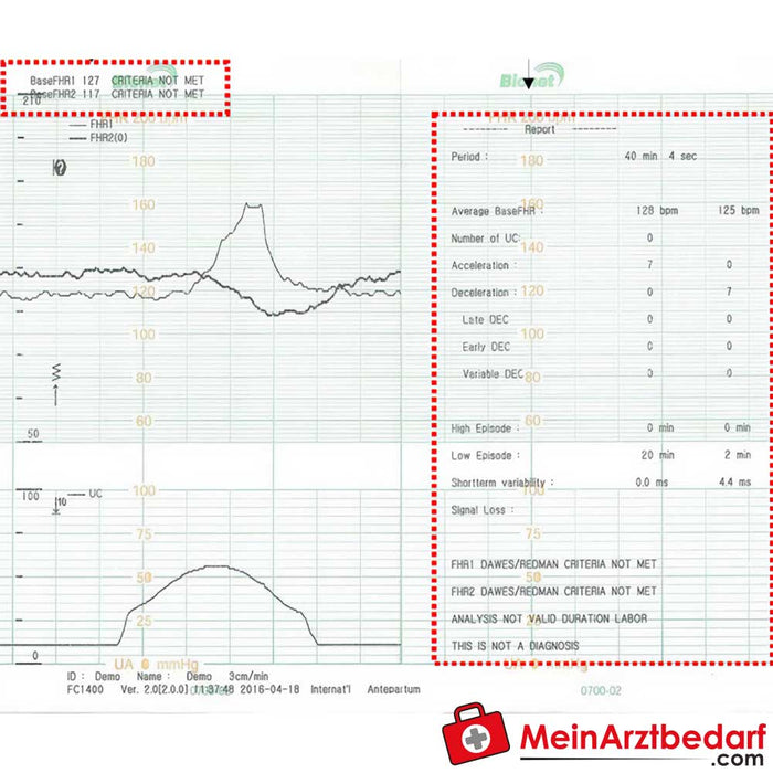 Medical Econet Smart 3 Twin foetale monitor