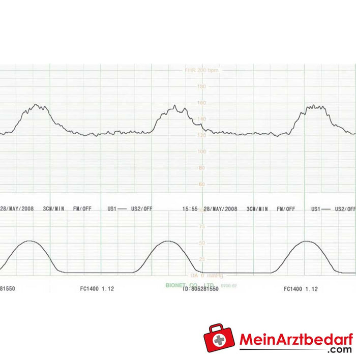 Monitor fetal gemelo Medical Econet Smart 3