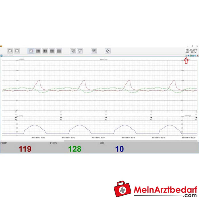 Monitor fetal gemelo Medical Econet Smart 3