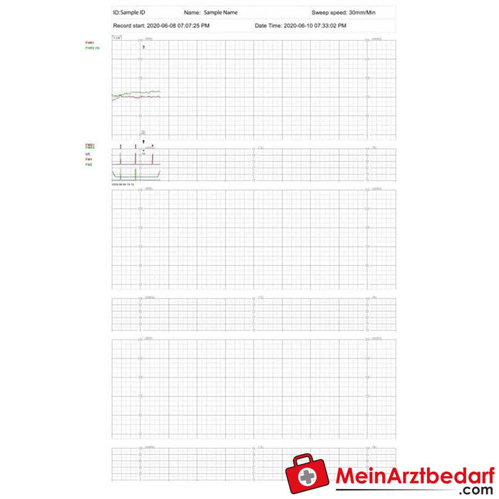 Medical Econet Smart 3 ikiz fetal monitör