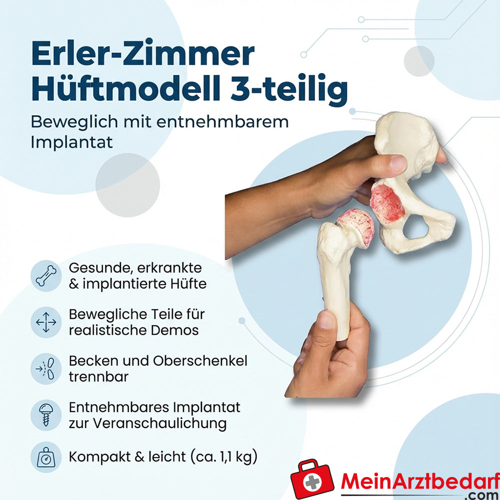 Modello di anca Erler Zimmer, in 3 parti, mobile con impianto rimovibile e supporto in perspex