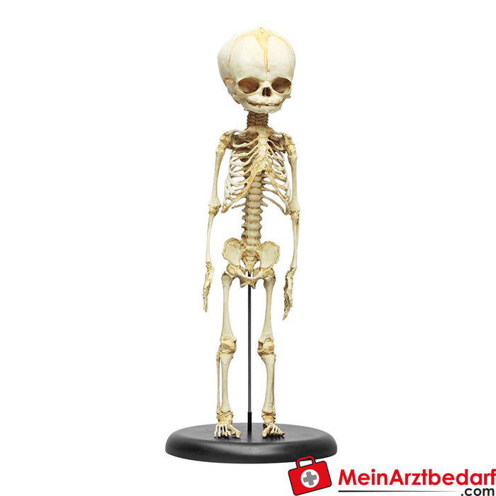 Erler Zimmer Foetaal skelet, 30 weken