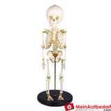 Erler Zimmer kinderskelet, 14 tot 16 maanden