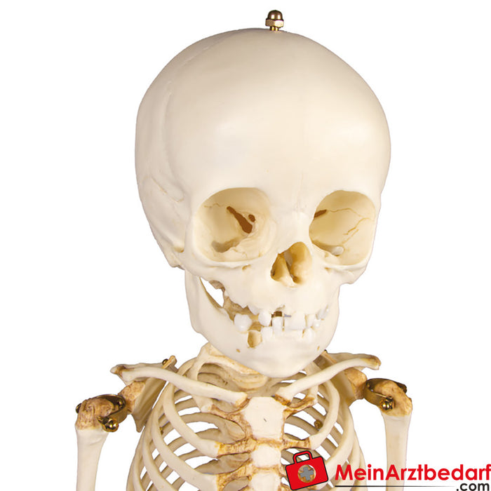 Erler Zimmer 儿童骨骼，14 至 16 个月