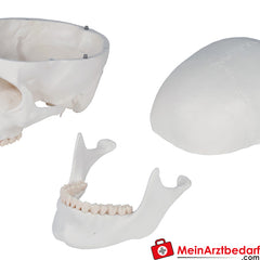 Erler-Zimmer Skelett.