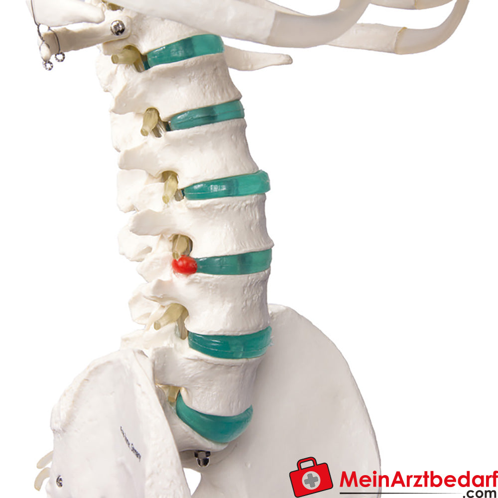 Erler-Zimmer Skelett.