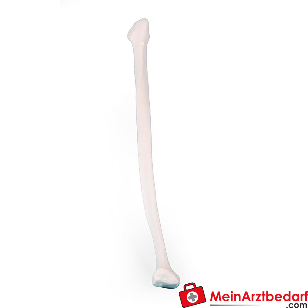 Erler-Zimmer Fibula (Wadenbein).