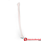 Erler-Zimmer Fibula (Wadenbein).