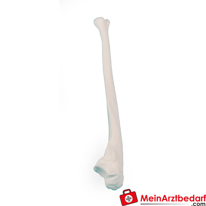 Erler Zimmer Ulna (cúbito)