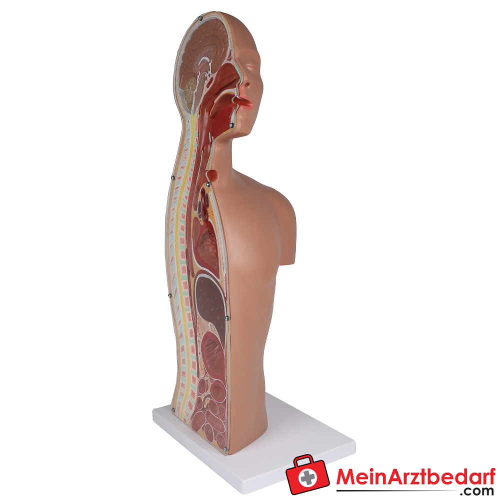 Erler-Zimmer NG Tracheostomie Torso, lebensgroß.