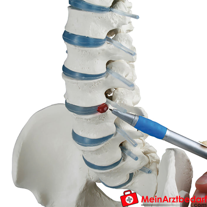 Erler Zimmer Coluna vertebral padrão com hérnia discal e pélvis