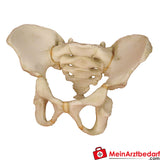 Erler Zimmer Bekken van een 6-jarig kind