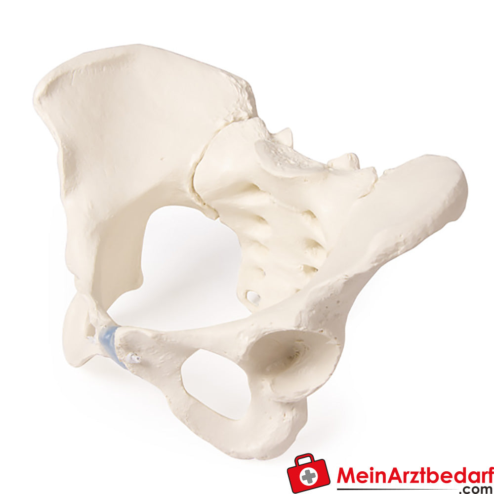 Erler-Zimmer Kreuzbein.