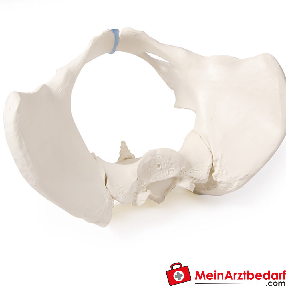 Erler-Zimmer Kreuzbein.